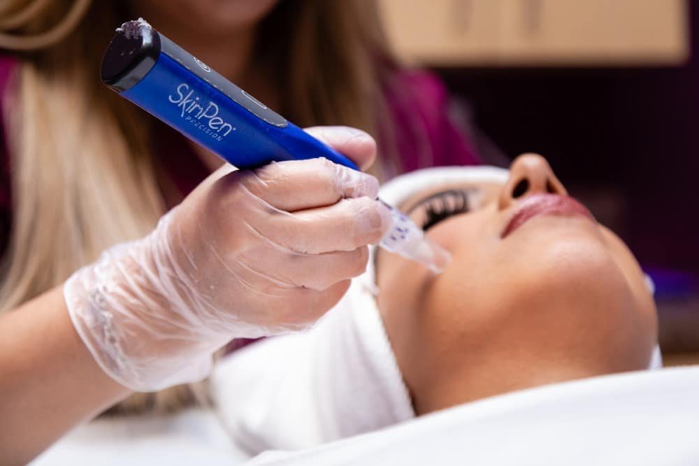 SkinPen Micro-needling
